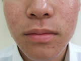 Before
