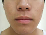 After